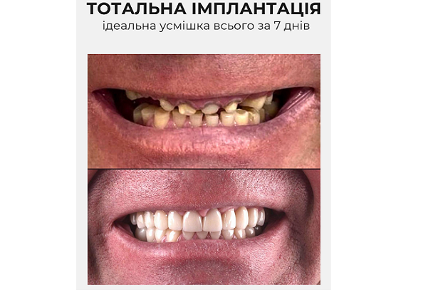 Стоматологія «Dentistman» (Дентістмен на Голосіївській)