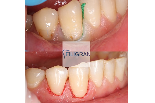 Стоматологія «Filigran» (Філігран)