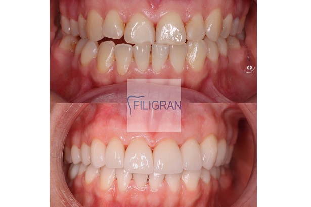 Стоматологія «Filigran» (Філігран)