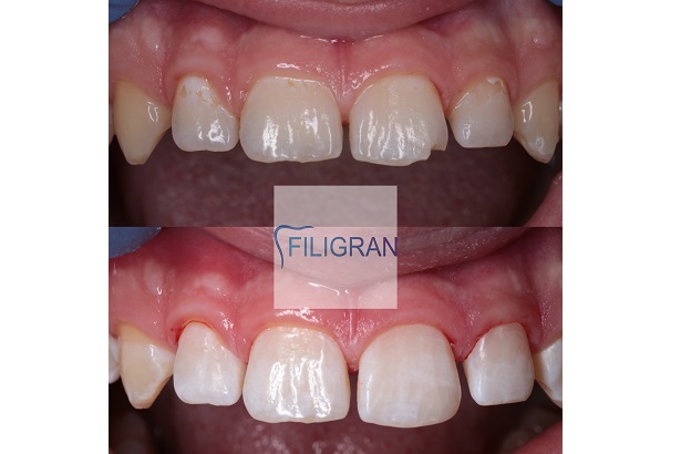 Стоматологія «Filigran» (Філігран)