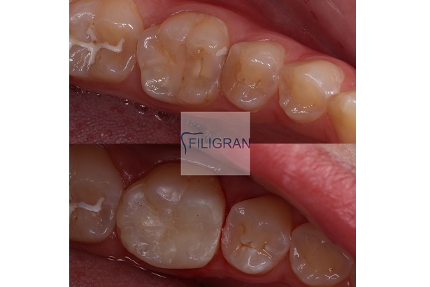 Стоматологія «Filigran» (Філігран)