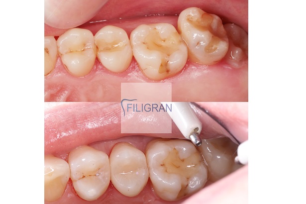 Стоматологія «Filigran» (Філігран)