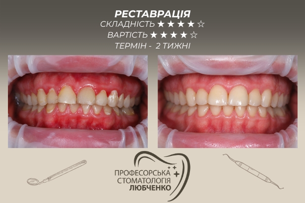 Стоматологія «Професорська стоматологія Любченко»