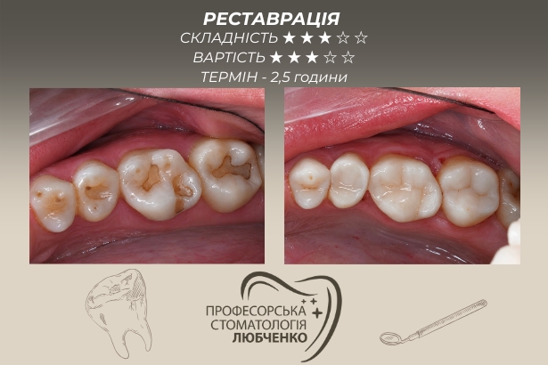 Стоматологія «Професорська стоматологія Любченко»