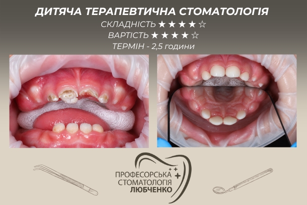 Стоматологія «Професорська стоматологія Любченко»