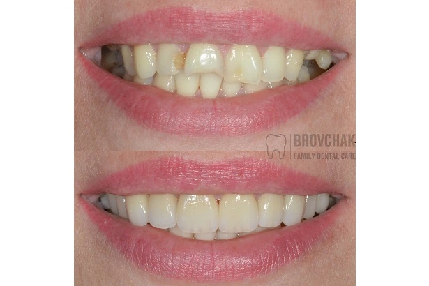 Dentistry «Brovchak Family Dental Care» on Dimeevskaya (Brovchak Family Dental Clinic)