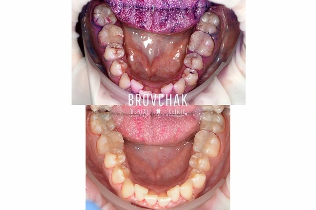 Стоматологія «Brovchak Dental Clinic» (Бровчак Дентал Клінік)