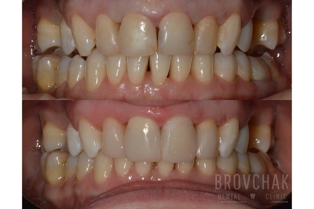 Dentistry «Brovchak Family Dental Care» on Dimeevskaya (Brovchak Family Dental Clinic)