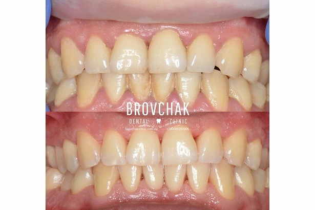 Стоматологія «Brovchak Dental Clinic» (Бровчак Дентал Клінік)