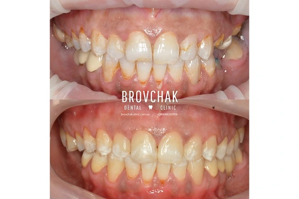 Стоматологія «Brovchak Dental Clinic» (Бровчак Дентал Клінік)