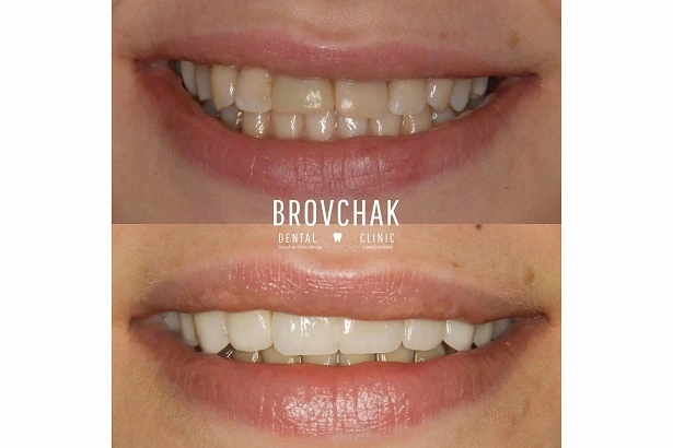 Стоматологія «Brovchak Dental Clinic» (Бровчак Дентал Клінік)
