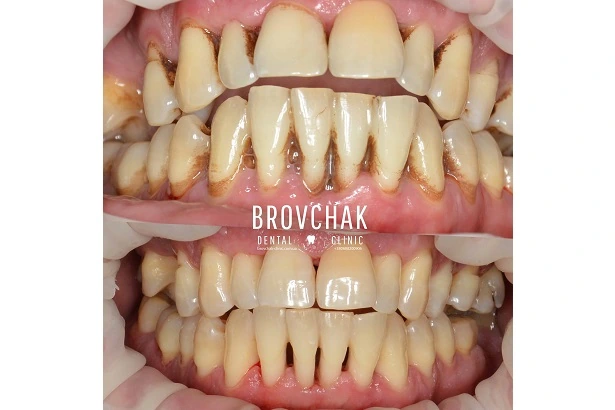 Dentistry «Brovchak Family Dental Care» on Dimeevskaya (Brovchak Family Dental Clinic)