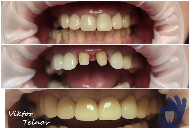 Стоматологія «Good Dental»  (Гудд Дентал)
