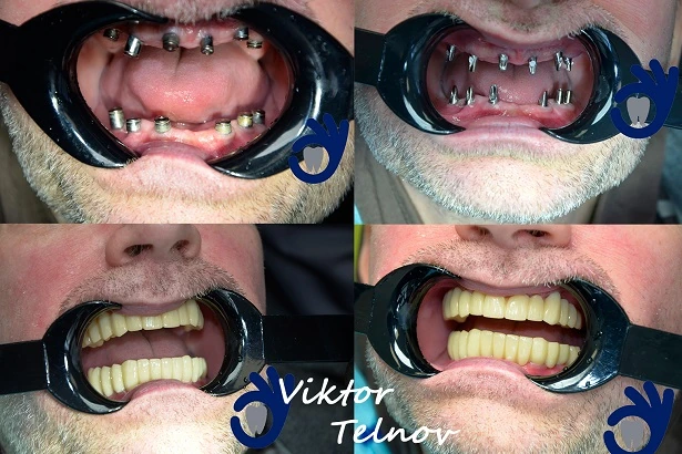 Стоматологія «Good Dental»  (Гудд Дентал)