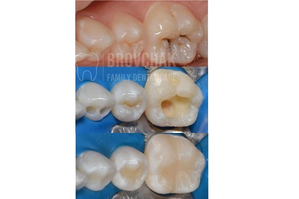 Dentistry «Brovchak Family Dental Care» on Dimeevskaya (Brovchak Family Dental Clinic)