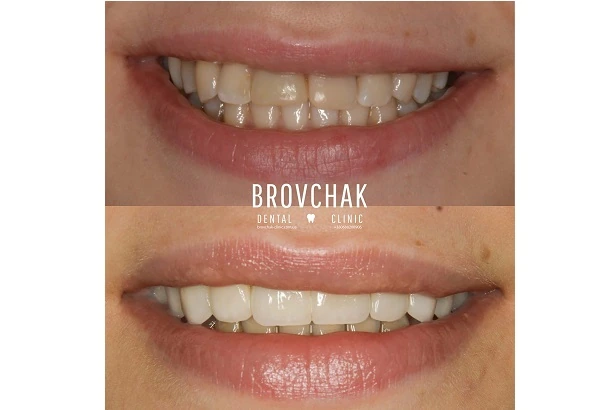 Dentistry «Brovchak Family Dental Care» on Dimeevskaya (Brovchak Family Dental Clinic)