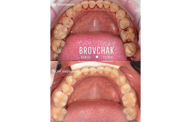 Стоматологія «Brovchak Dental Clinic» (Бровчак Дентал Клінік)