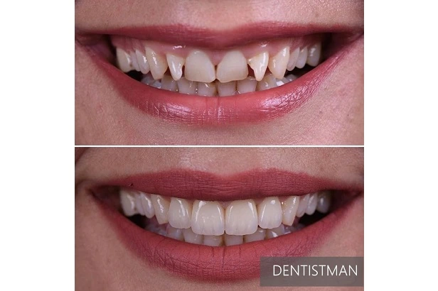Стоматологія «Dentistman» (Дентістмен на Голосіївській)