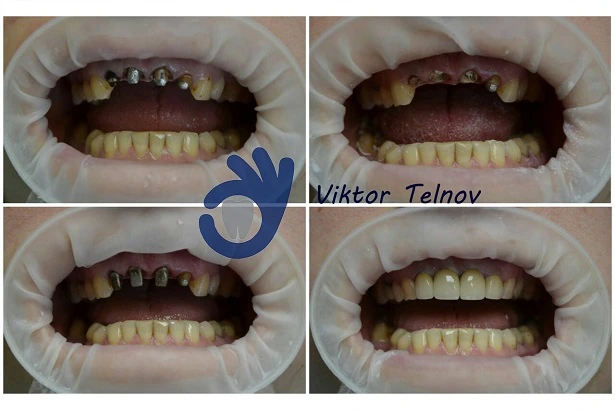 Стоматологія «Good Dental»  (Гудд Дентал)