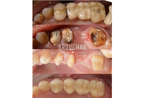 Dentistry «Brovchak Family Dental Care» on Dimeevskaya (Brovchak Family Dental Clinic)