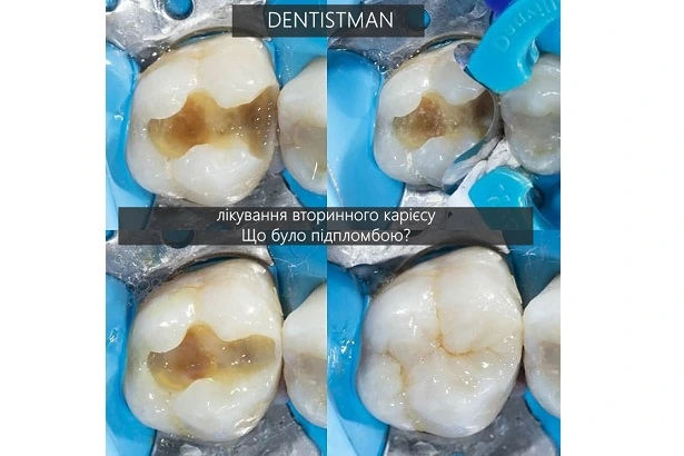 Стоматологія «Dentistman» (Дентістмен на Голосіївській)
