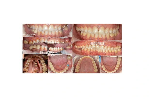 Dentistry «Brovchak Family Dental Care» on Dimeevskaya (Brovchak Family Dental Clinic)