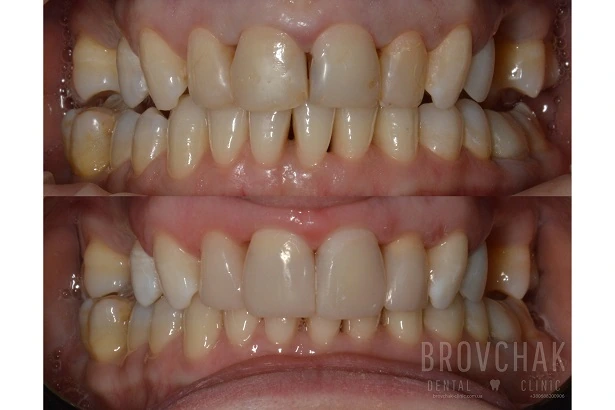 Стоматологія «Brovchak Dental Clinic» (Бровчак Дентал Клінік)