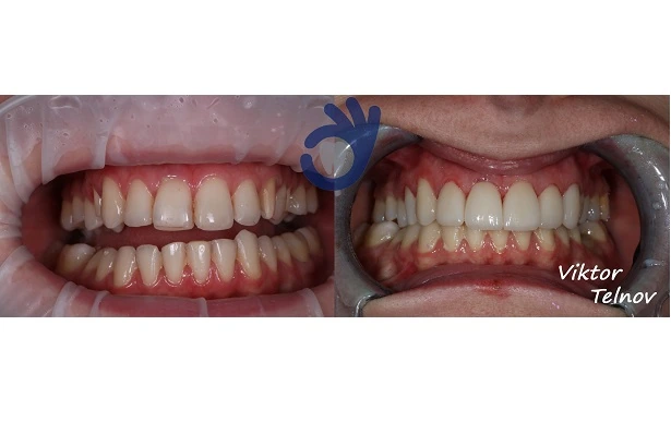 Стоматологія «Good Dental»  (Гудд Дентал)