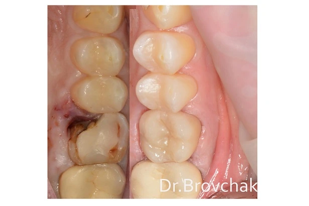 Стоматологія «Brovchak Dental Clinic» (Бровчак Дентал Клінік)