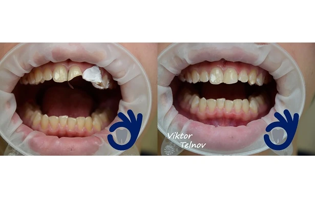 Стоматологія «Good Dental»  (Гудд Дентал)