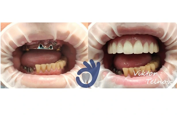 Стоматологія «Good Dental»  (Гудд Дентал)