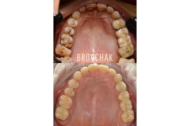 Стоматологія «Brovchak Dental Clinic» (Бровчак Дентал Клінік)