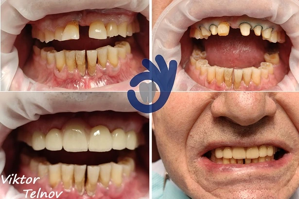 Стоматологія «Good Dental»  (Гудд Дентал)