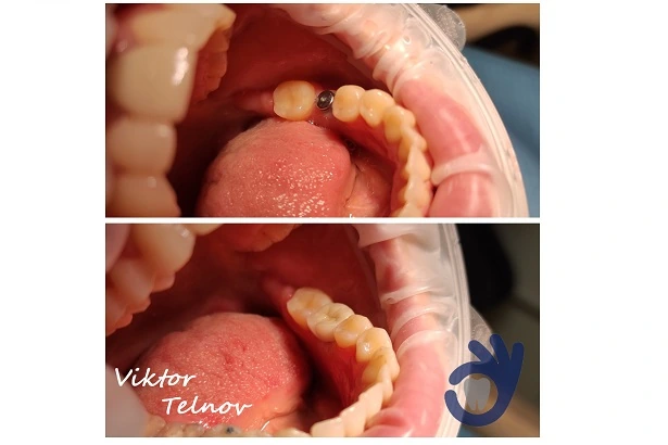 Стоматологія «Good Dental»  (Гудд Дентал)