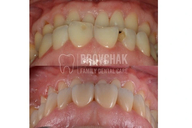 Dentistry «Brovchak Family Dental Care» on Dimeevskaya (Brovchak Family Dental Clinic)