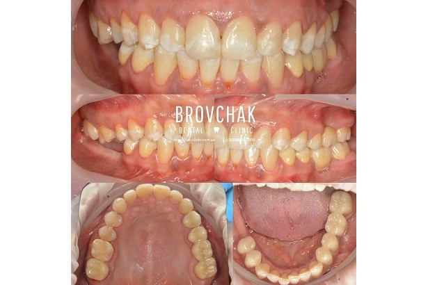 Dentistry «Brovchak Family Dental Care» on Dimeevskaya (Brovchak Family Dental Clinic)