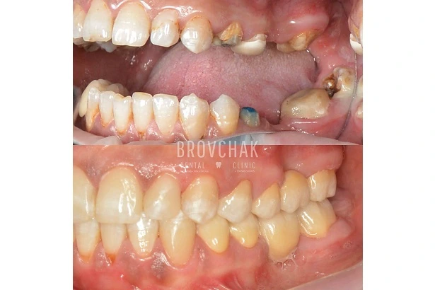 Dentistry «Brovchak Family Dental Care» on Dimeevskaya (Brovchak Family Dental Clinic)