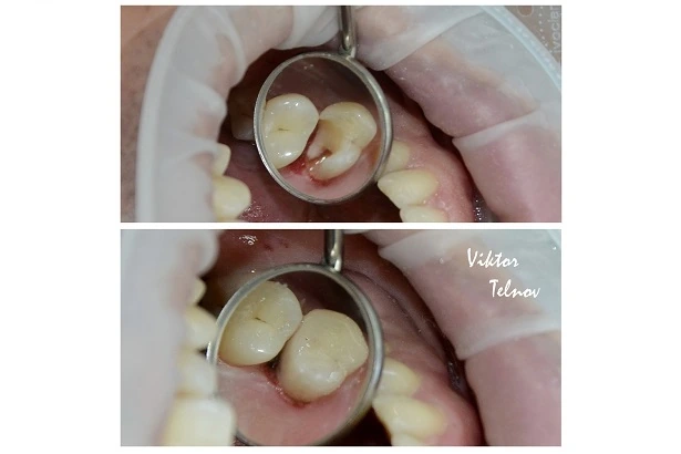 Стоматологія «Good Dental»  (Гудд Дентал)