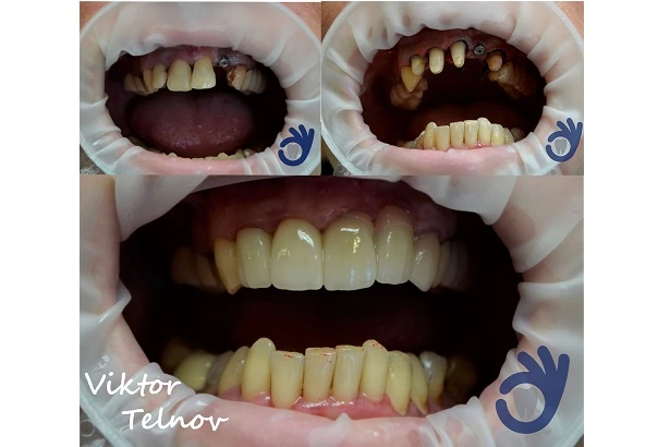 Стоматологія «Good Dental»  (Гудд Дентал)