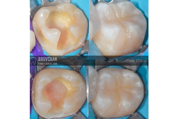 Dentistry «Brovchak Family Dental Care» on Dimeevskaya (Brovchak Family Dental Clinic)