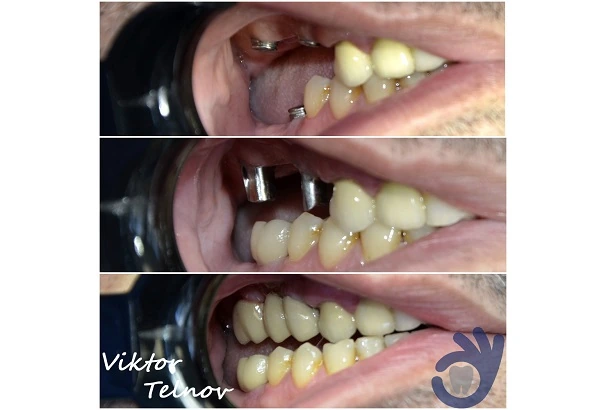 Стоматологія «Good Dental»  (Гудд Дентал)