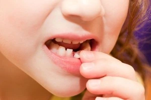 Коли випадають молочні зуби у дитини, зміна зубів
