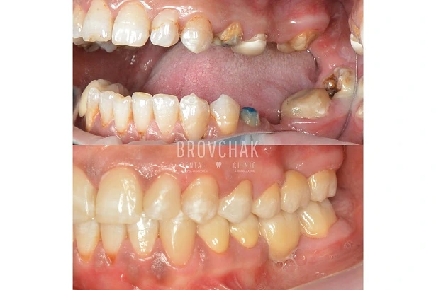 Стоматологія «Brovchak Dental Clinic» (Бровчак Дентал Клінік)