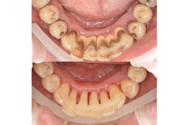 Dentistry «Brovchak Family Dental Care» on Dimeevskaya (Brovchak Family Dental Clinic)