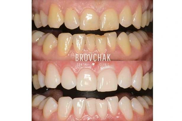 Dentistry «Brovchak Family Dental Care» on Dimeevskaya (Brovchak Family Dental Clinic)