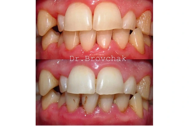 Dentistry «Brovchak Family Dental Care» on Dimeevskaya (Brovchak Family Dental Clinic)