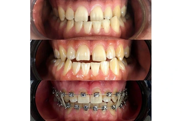 Стоматологія «Dental Guru» (Дентал Гуру)