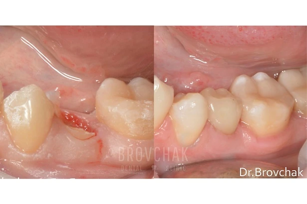 Стоматологія «Brovchak Dental Clinic» (Бровчак Дентал Клінік)