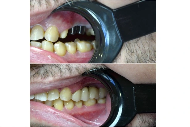 Стоматологія «Good Dental»  (Гудд Дентал)