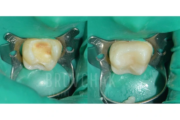 Стоматологія «Brovchak Dental Clinic» (Бровчак Дентал Клінік)